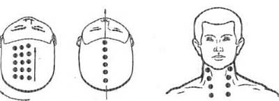 Нажмите на изображение для увеличения
Название: Как избавиться от тяжести в голове.jpg
Просмотров: 604
Размер: 20.3 Кб
ID: 866